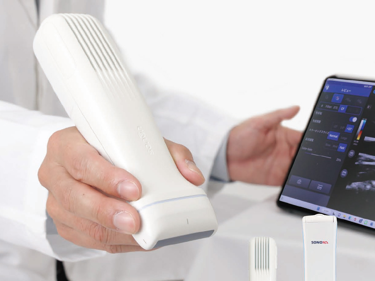 SONON:音波画像診断装置